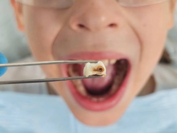Emergency Gum Pain Relief in TX